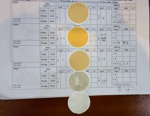 Theo dõi kết quả đo mat do bun SDI